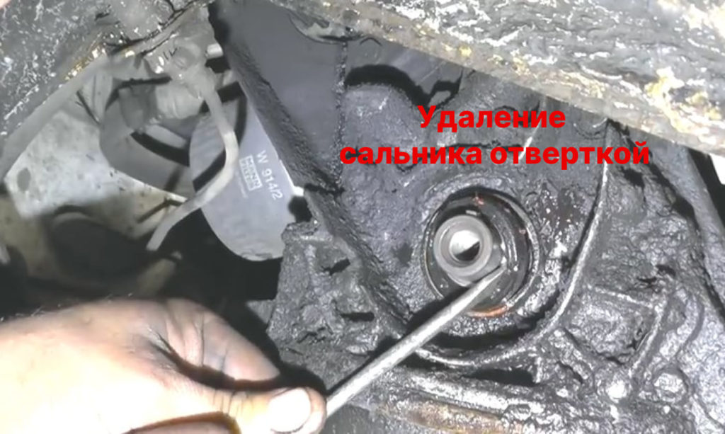 удаление сальника